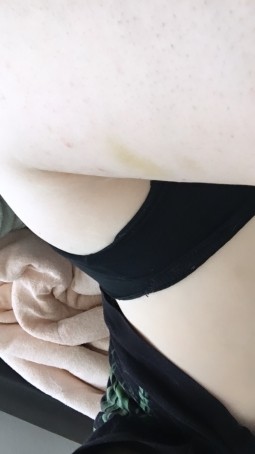 Meow, 19, Malta