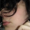 Adina