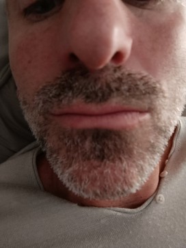 Francesco Francesco, 41, France