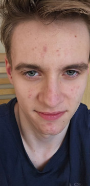 Elias, 18, Sweden