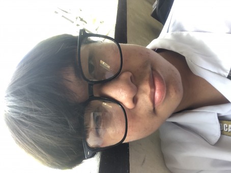 James Kelly Matildo, 18, Philippines