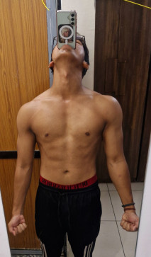 Anonymous, 21, India