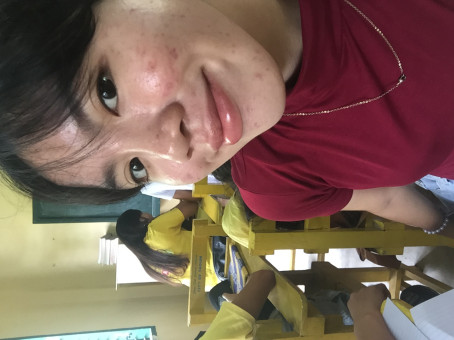 Peng, 18, Philippines