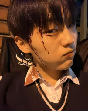 Kyoshimo, 21, Philippines