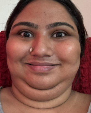 Helly, 20, India