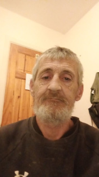 Plaster Master, 50, Ireland