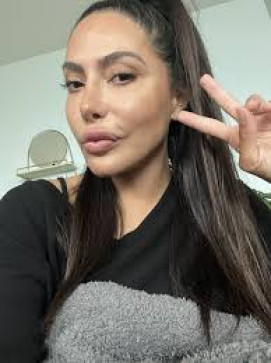 Stellapette, 30, United States