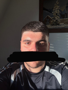 , 18, Albania