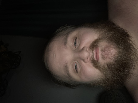 Eyeless Jack, 28, United States