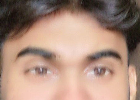 Aldosterone, 21, India