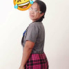 mscurvy