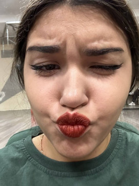 Layla Dunchaine, 18, Madagascar