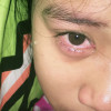 amel ppp