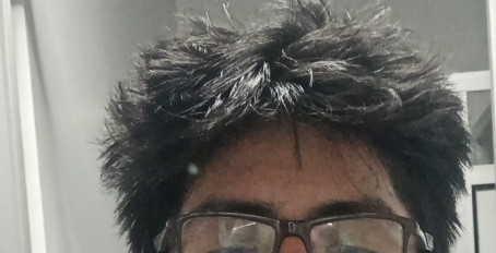 Amit Alejandro Deza, 20, Peru