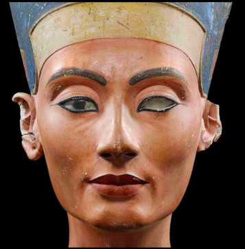 Echo Angle, 29, Canada