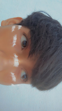 Saroj Rawat, 19, India