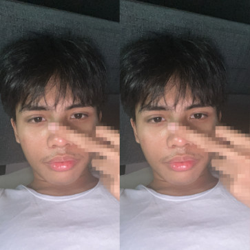 Littlebottom, 18, Philippines