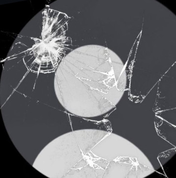 Aashik Khan, 18, India