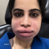 Manya