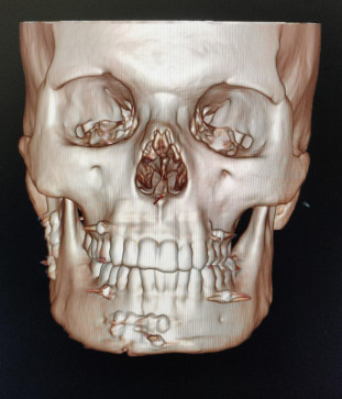 ChutPremi, 31, India