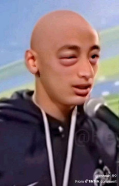 Swapnli Hadal, 20, India