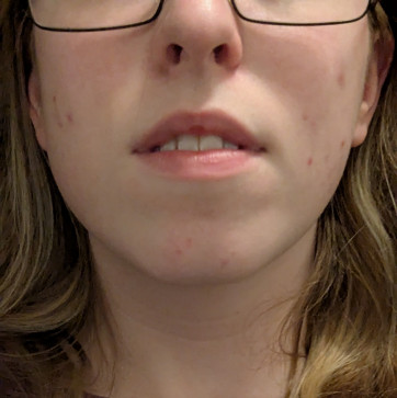 Madeline, 18, United Kingdom