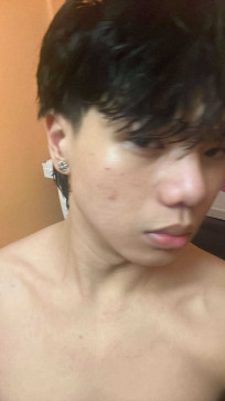 John Baster, 18, Philippines