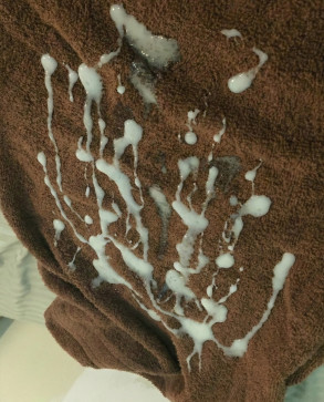 Louis, 99, United States