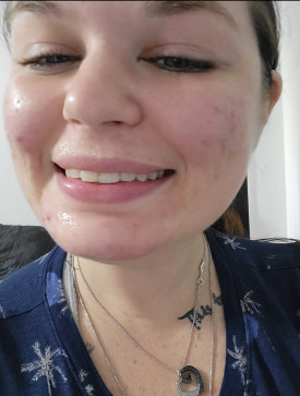 Beck Shannon, 28, United States