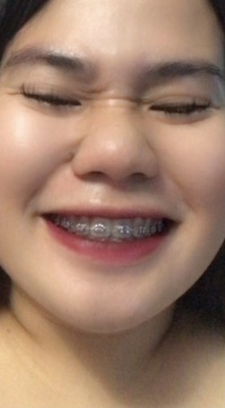JustWannaTalk, 29, Philippines