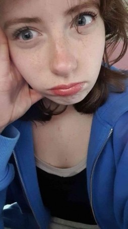 Bi-Rose, 20, Germany